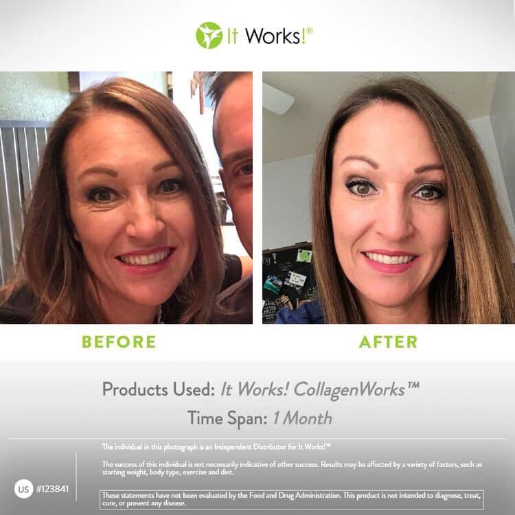 Transformation Collagène Avant Après avec Collagenworks It Works - 1 mois