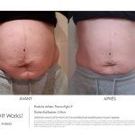 it works perte de poids avant apres 2 mois